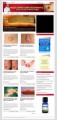 Moles, Warts And Skin Removal Plr Niche Blog PLR Template 