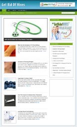 Hives Blog Personal Use Template With Video