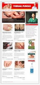 Toenail Fungus Niche Blog PLR Template