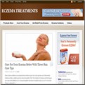 Eczema Treatments Blog Personal Use Template With Video