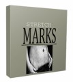 Stretch Marks Niche Website Bundle Personal Use Template