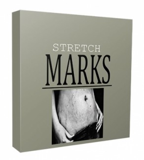 Stretch Marks Niche Website Bundle Personal Use Template