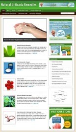 Urticaria Remedies Niche Blog Personal Use Template