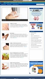 Scabies Niche Blog Personal Use Template With Video